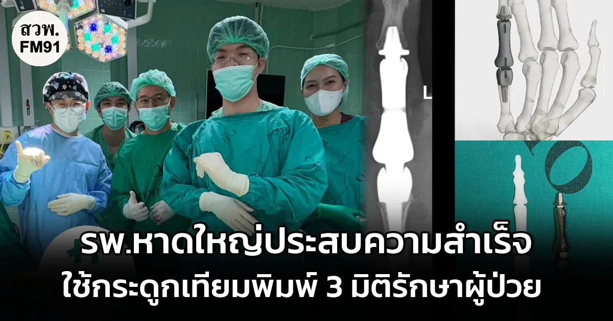 รพ.หาดใหญ่ประสบความสำเร็จ ใช้กระดูกเทียมพิมพ์ 3 มิติ รักษาเนื้องอกกระดูกนิ้วก้อย มุ่งรักษานิ้วมือให้ใช้งานได้มากที่สุด